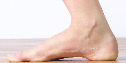 What You Should Know If You Have High Arches